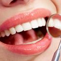 Cosmetic dentistry and how it can help you